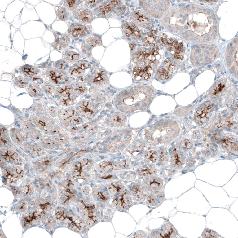 Immunohistochemistry (Formalin/PFA-fixed paraffin-embedded sections) - Anti-SLC6A14 antibody (AB254786)