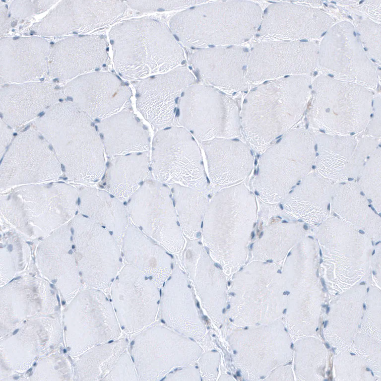 Immunohistochemistry (Formalin/PFA-fixed paraffin-embedded sections) - Anti-SLC6A14 antibody (AB254786)
