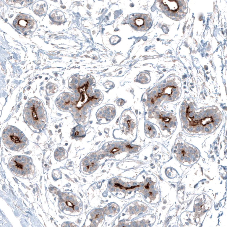 Immunohistochemistry (Formalin/PFA-fixed paraffin-embedded sections) - Anti-SLC6A14 antibody (AB254786)