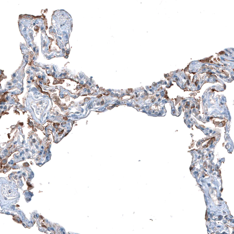Immunohistochemistry (Formalin/PFA-fixed paraffin-embedded sections) - Anti-SLC6A14 antibody (AB254786)