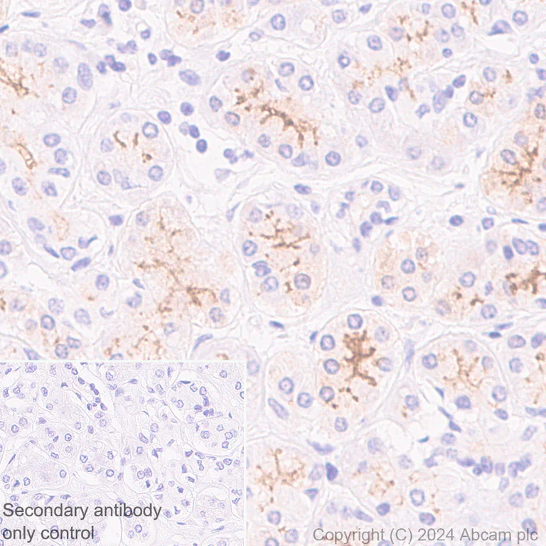 Immunohistochemistry (Formalin/PFA-fixed paraffin-embedded sections) - Anti-SLC6A14 antibody [EPR27113-178] (AB316193)