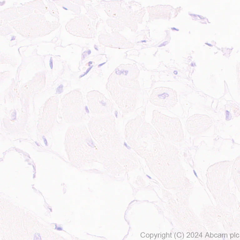 Immunohistochemistry (Formalin/PFA-fixed paraffin-embedded sections) - Anti-SLC6A14 antibody [EPR27113-178] (AB316193)