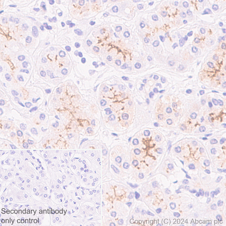 Immunohistochemistry (Formalin/PFA-fixed paraffin-embedded sections) - Anti-SLC6A14 antibody [EPR27113-178] - BSA and Azide free (AB316194), expandable thumbnail