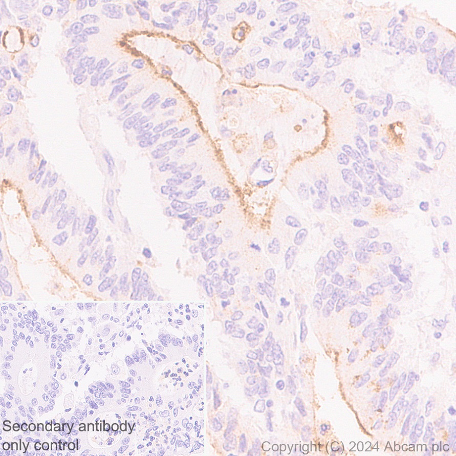 Immunohistochemistry (Formalin/PFA-fixed paraffin-embedded sections) - Anti-SLC6A14 antibody [EPR27113-178] - BSA and Azide free (AB316194), expandable thumbnail