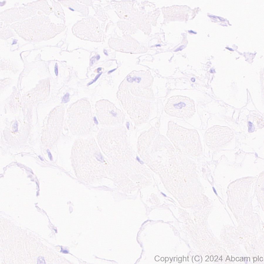 Immunohistochemistry (Formalin/PFA-fixed paraffin-embedded sections) - Anti-SLC6A14 antibody [EPR27113-178] - BSA and Azide free (AB316194), expandable thumbnail