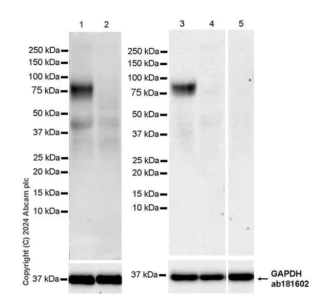 Western blot - Anti-SLC6A14 antibody [EPR27113-178] - BSA and Azide free (AB316194)