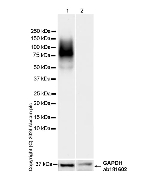 Western blot - Anti-SLC6A14 antibody [EPR27113-178] - BSA and Azide free (AB316194)