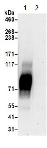 Immunoprecipitation - Anti-SLC6A15 antibody (AB191192)