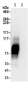 Immunoprecipitation - Anti-SLC6A15 antibody (AB191192)