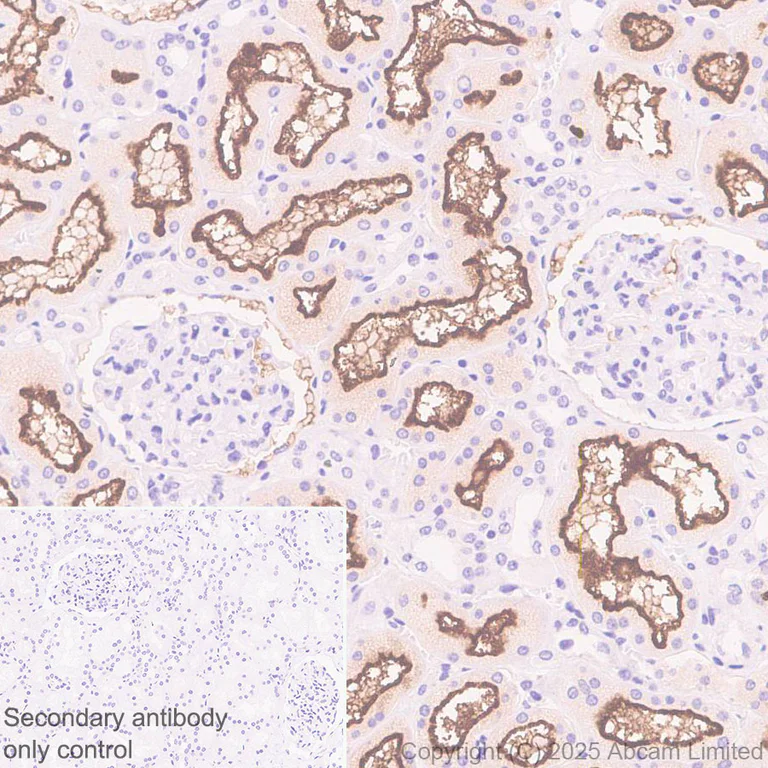 Immunohistochemistry (Formalin/PFA-fixed paraffin-embedded sections) - Anti-SLC6A19 antibody [EPR30005-529] (AB326561)