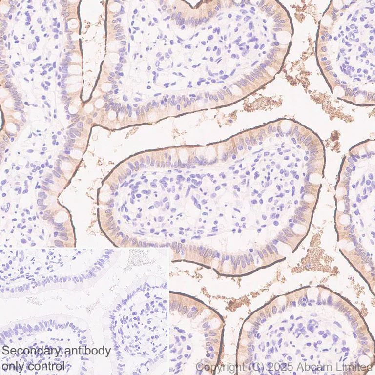 Immunohistochemistry (Formalin/PFA-fixed paraffin-embedded sections) - Anti-SLC6A19 antibody [EPR30005-529] (AB326561)