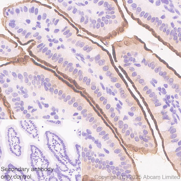 Immunohistochemistry (Formalin/PFA-fixed paraffin-embedded sections) - Anti-SLC6A19 antibody [EPR30005-529] (AB326561)