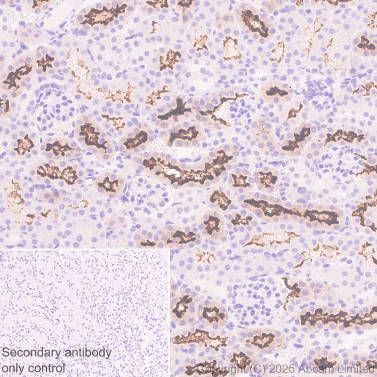 Immunohistochemistry (Formalin/PFA-fixed paraffin-embedded sections) - Anti-SLC6A19 antibody [EPR30005-529] (AB326561)