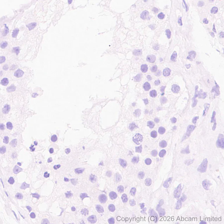 Immunohistochemistry (Formalin/PFA-fixed paraffin-embedded sections) - Anti-SLC6A19 antibody [EPR30005-529] (AB326561)