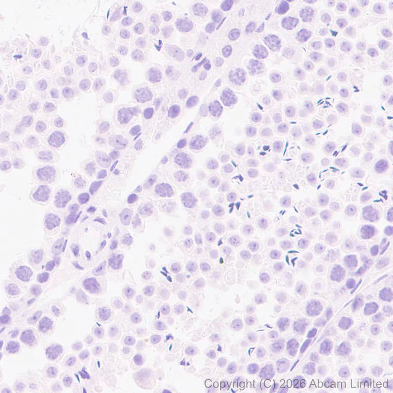 Immunohistochemistry (Formalin/PFA-fixed paraffin-embedded sections) - Anti-SLC6A19 antibody [EPR30005-529] (AB326561)