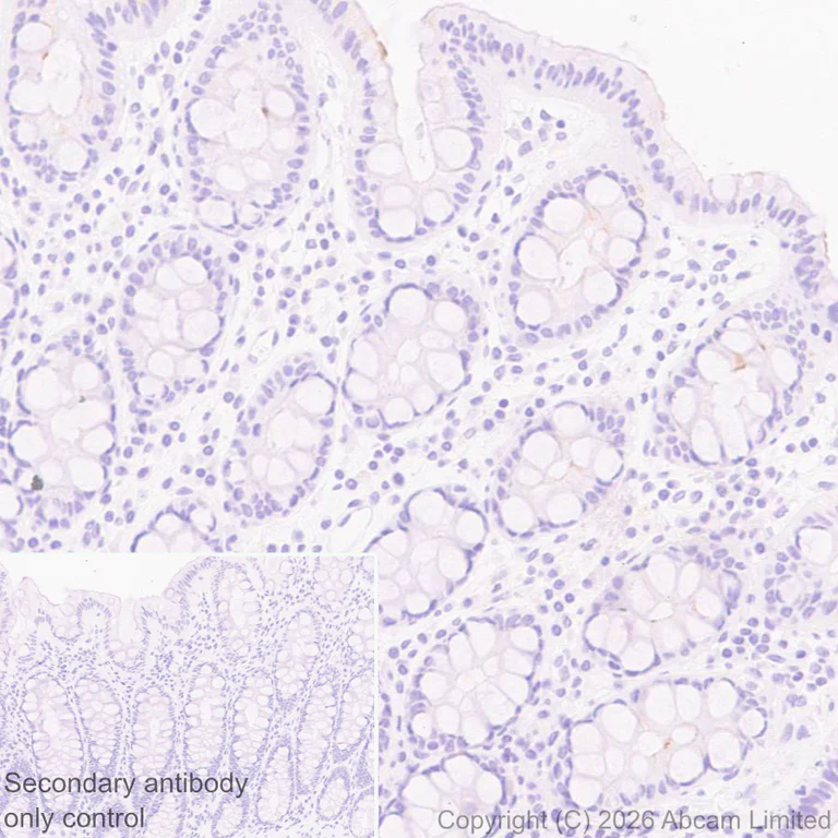 Immunohistochemistry (Formalin/PFA-fixed paraffin-embedded sections) - Anti-SLC6A19 antibody [EPR30005-529] (AB326561)