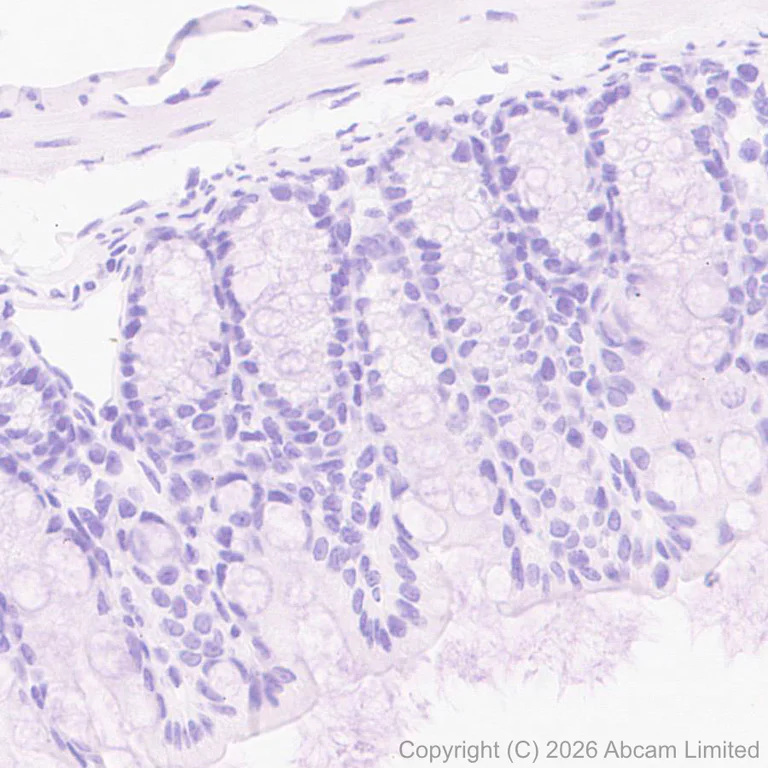 Immunohistochemistry (Formalin/PFA-fixed paraffin-embedded sections) - Anti-SLC6A19 antibody [EPR30005-529] (AB326561)