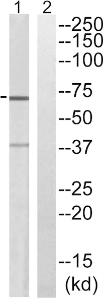 Western blot - Anti-Slc6a6/Taut antibody (AB196821)