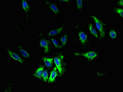 Immunocytochemistry/ Immunofluorescence - Anti-Slc6a6/Taut antibody (AB236898)