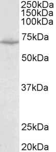 Western blot - Anti-SLC6A8 antibody (AB130132), expandable thumbnail
