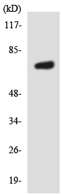 Western blot - Anti-SLC6A8 antibody (AB137198)