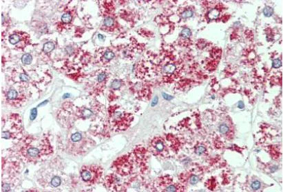 Immunohistochemistry (Formalin/PFA-fixed paraffin-embedded sections) - Anti-SLC7A2/CAT2 antibody (AB140831)