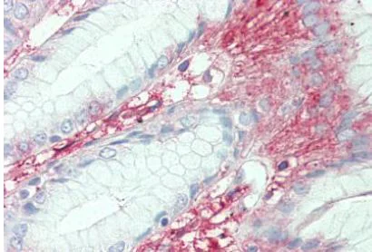 Immunohistochemistry (Formalin/PFA-fixed paraffin-embedded sections) - Anti-SLC7A2/CAT2 antibody (AB140831)