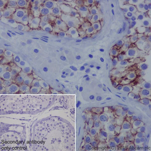 Immunohistochemistry (Formalin/PFA-fixed paraffin-embedded sections) - Anti-SLC7A5/LAT1 antibody [EPR17573] - BSA and Azide free (AB215822)