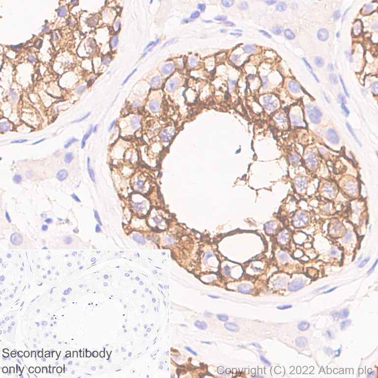 Immunohistochemistry (Formalin/PFA-fixed paraffin-embedded sections) - Anti-SLC7A5/LAT1 antibody [EPR26260-66] (AB305251)