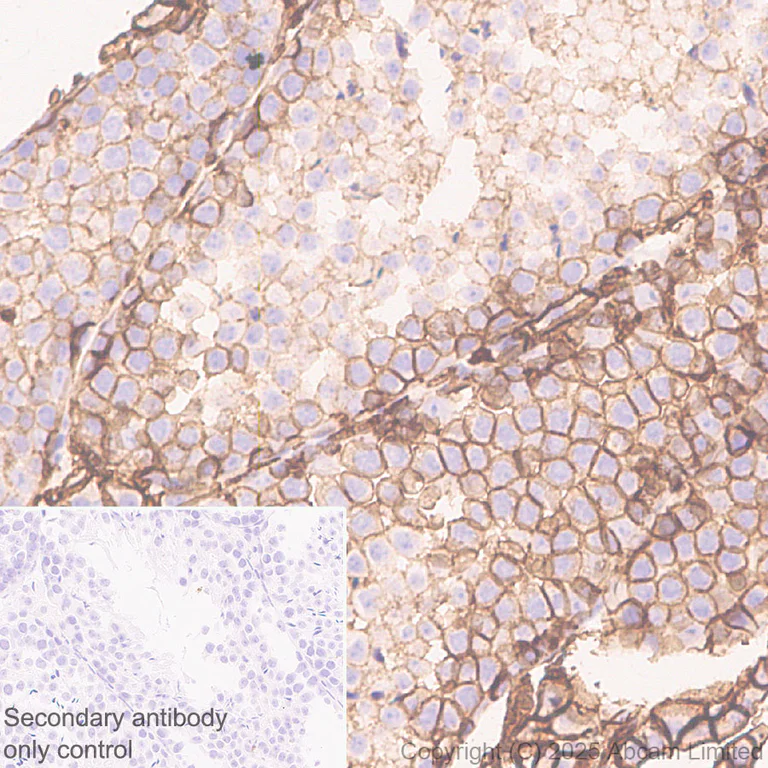 Immunohistochemistry (Formalin/PFA-fixed paraffin-embedded sections) - Anti-SLC7A5/LAT1 antibody [EPR29892-591] (AB324354)