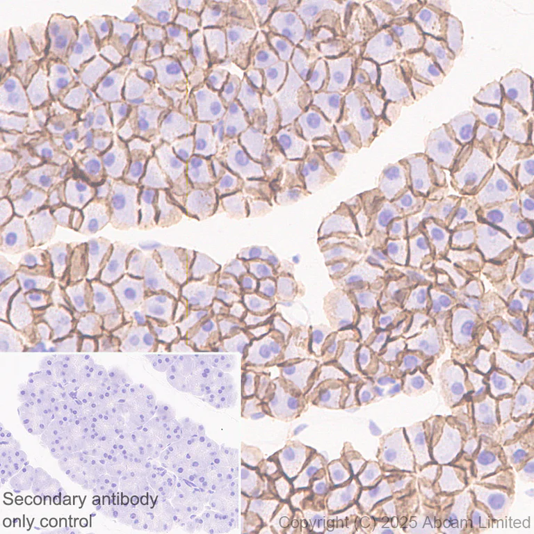 Immunohistochemistry (Formalin/PFA-fixed paraffin-embedded sections) - Anti-SLC7A5/LAT1 antibody [EPR29892-591] (AB324354)