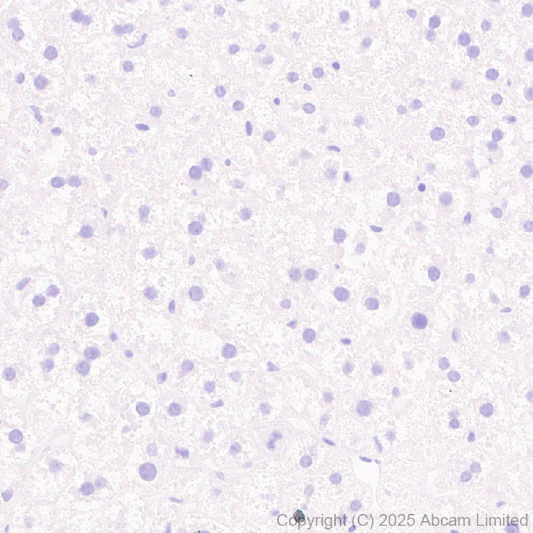 Immunohistochemistry (Formalin/PFA-fixed paraffin-embedded sections) - Anti-SLC7A5/LAT1 antibody [EPR29892-591] (AB324354)