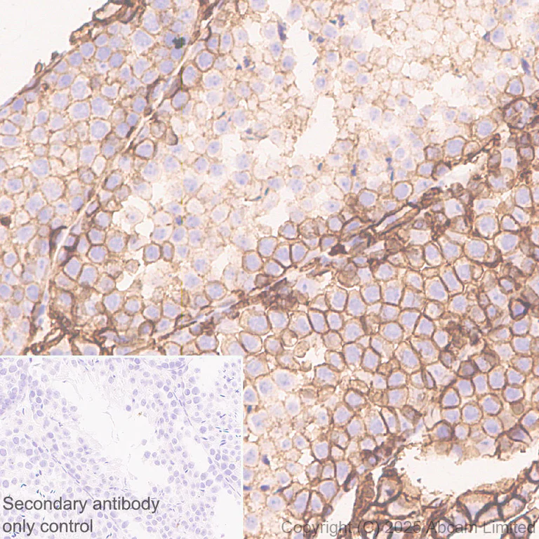 Immunohistochemistry (Formalin/PFA-fixed paraffin-embedded sections) - Anti-SLC7A5/LAT1 antibody [EPR29892-591] - BSA and Azide free (AB325953)