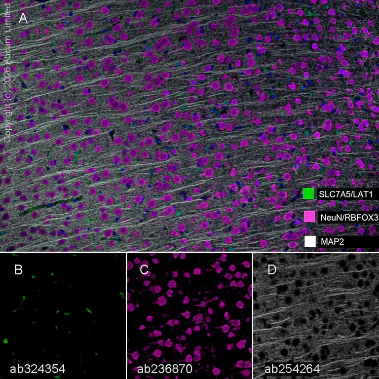 Multiplex immunohistochemistry - Anti-SLC7A5/LAT1 antibody [EPR29892-591] - BSA and Azide free (AB325953)