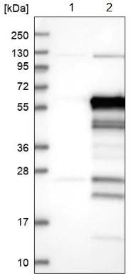 Western blot - Anti-SLC7A6OS antibody (AB122727)
