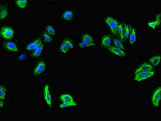 Immunocytochemistry/ Immunofluorescence - Anti-SLC7A7 antibody (AB236669)