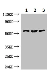 Western blot - Anti-SLC7A7 antibody (AB236669)