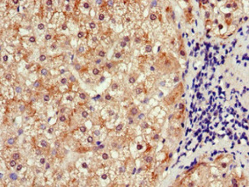 Immunohistochemistry (Formalin/PFA-fixed paraffin-embedded sections) - Anti-SLCO1B3/OATP1B3 antibody (AB222900)
