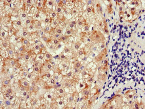 Immunohistochemistry (Formalin/PFA-fixed paraffin-embedded sections) - Anti-SLCO1B3/OATP1B3 antibody (AB222900)