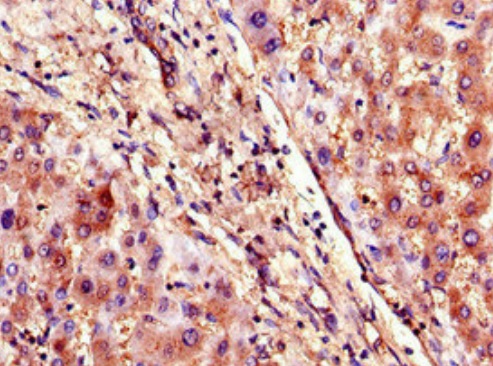 Immunohistochemistry (Formalin/PFA-fixed paraffin-embedded sections) - Anti-SLCO1B3/OATP1B3 antibody (AB222900)