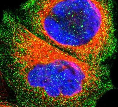 Immunocytochemistry/ Immunofluorescence - Anti-SLCO1B3/OATP1B3 antibody (AB224064)