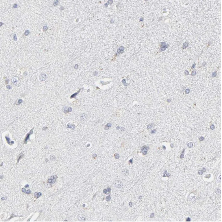 Immunohistochemistry (Formalin/PFA-fixed paraffin-embedded sections) - Anti-SLCO1B3/OATP1B3 antibody (AB224064)