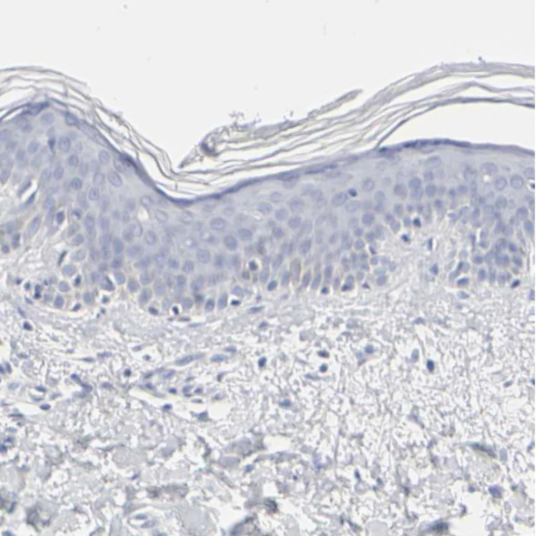 Immunohistochemistry (Formalin/PFA-fixed paraffin-embedded sections) - Anti-SLCO1B3/OATP1B3 antibody (AB224064)