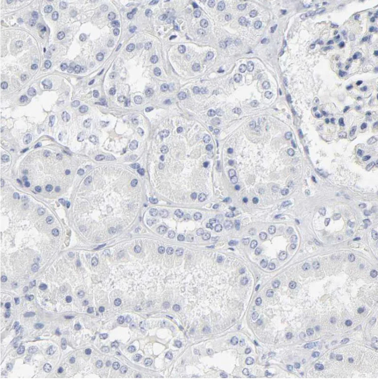 Immunohistochemistry (Formalin/PFA-fixed paraffin-embedded sections) - Anti-SLCO1B3/OATP1B3 antibody (AB224064)
