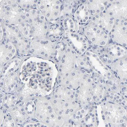 Immunohistochemistry (Formalin/PFA-fixed paraffin-embedded sections) - Anti-SLCO1B3/OATP1B3 antibody (AB224064)