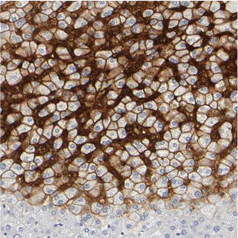 Immunohistochemistry (Formalin/PFA-fixed paraffin-embedded sections) - Anti-SLCO1B3/OATP1B3 antibody (AB224064)