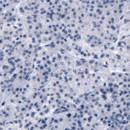 Immunohistochemistry (Formalin/PFA-fixed paraffin-embedded sections) - Anti-SLCO1B3/OATP1B3 antibody [CL3770] (AB242368), expandable thumbnail