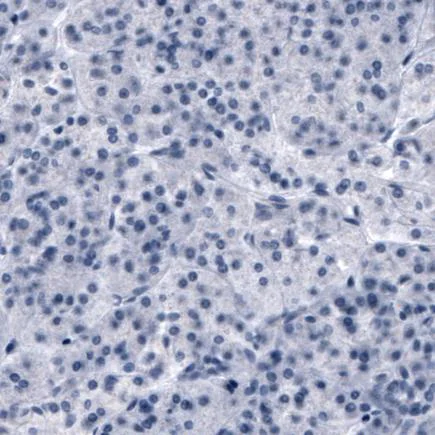 Immunohistochemistry (Formalin/PFA-fixed paraffin-embedded sections) - Anti-SLCO1B3/OATP1B3 antibody [CL3770] (AB242368)