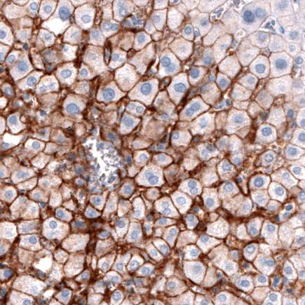 Immunohistochemistry (Formalin/PFA-fixed paraffin-embedded sections) - Anti-SLCO1B3/OATP1B3 antibody [CL3770] (AB242368)