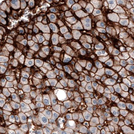 Immunohistochemistry (Formalin/PFA-fixed paraffin-embedded sections) - Anti-SLCO1B3/OATP1B3 antibody [CL3771] (AB242360)